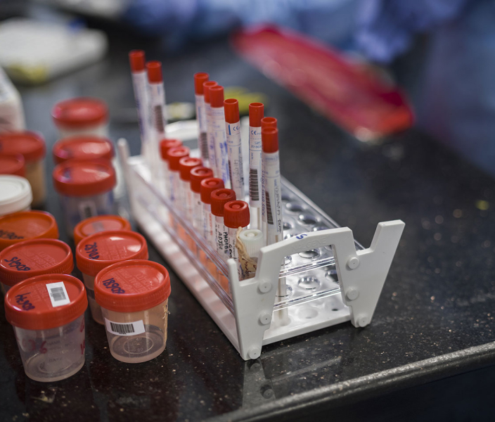 Progress report African region 21 2.8. Testing and laboratory